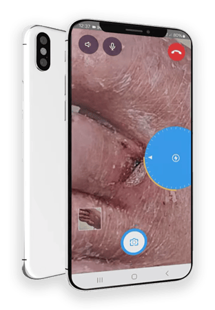 smart-camera-podiatry